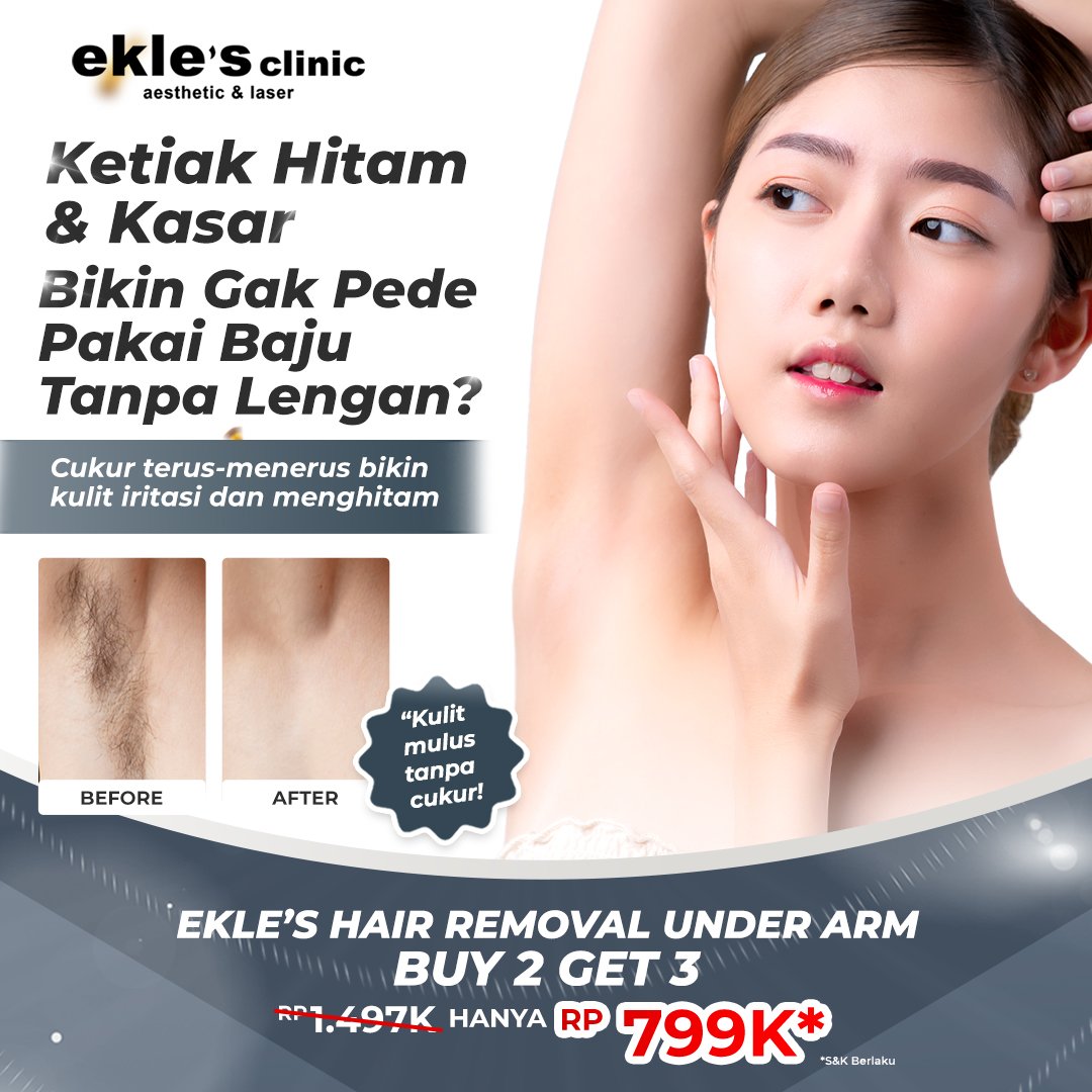 HAIR REMOVAL LASER-UNDER ARM (B2G3)