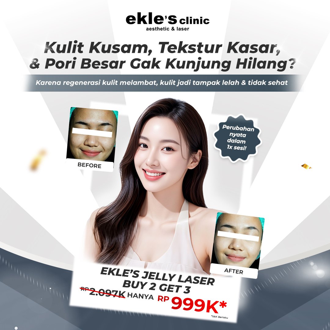 JELLY LASER-AUTO GLOWING (B2G3)