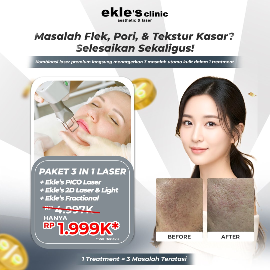 3LAYER LASER (PICO/NANO-2D-FRACTIONAL)